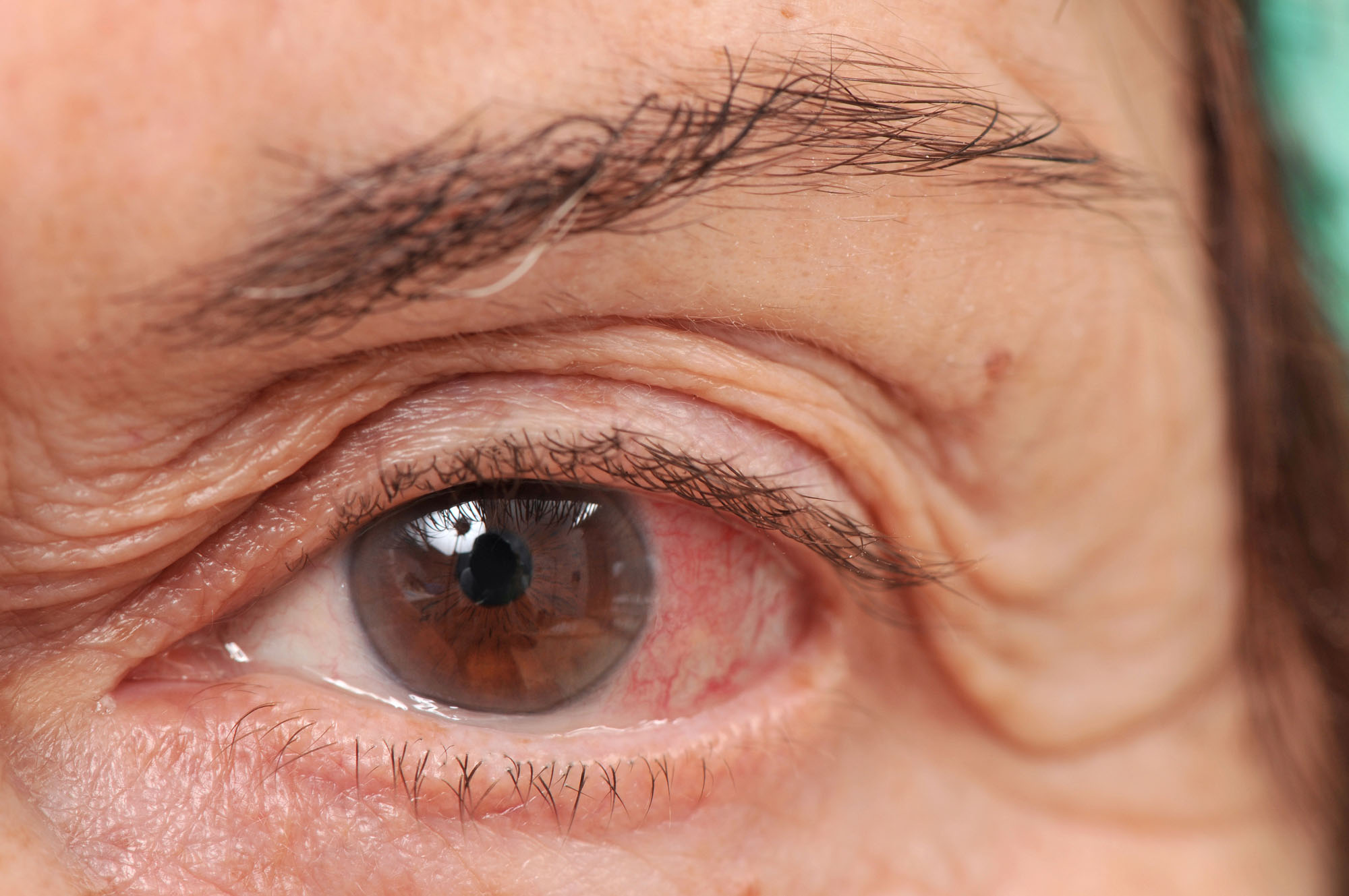 Home care helps seniors with macular degeneration live safely at home